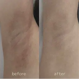 ROMA PINK 脇 モニター定価より40%OFF