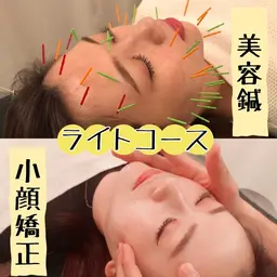 【40本使用】美容鍼＋小顔矯正🌟ライトコース