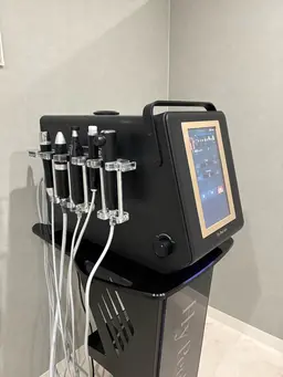 本日空き◎【平日限定】全顔毛穴洗浄¥7,700→¥3,000🫧