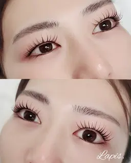 パリジェンヌリフト