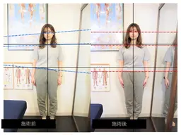 🔷姿勢改善【胸椎✖️肋骨リフト】背中でマイナス5歳若見え❗️🔷肩甲骨はがし🔷疲労回復🔷カイロで叶える美人化計画!