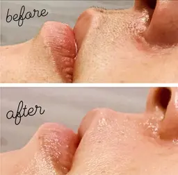 【フェイス全体WAX脱毛+鎮静パック】お仕事帰りOK👩女性限定