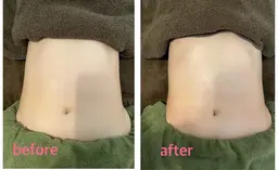 【免疫力アップ】ドライヘッドスパ45分＋腸リンパ45分 90分