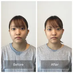 『施術後アンケート』ミニモ限定小顔ケアと骨盤ケア＋お悩み別OP50分¥15900-＜小顔解消/小顔姿勢/顔のバランス＞