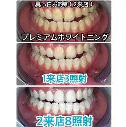 【人気No.1】プレミアムコース❣合計 8回 2 来店（1回10分照射）❣ジェル代別途