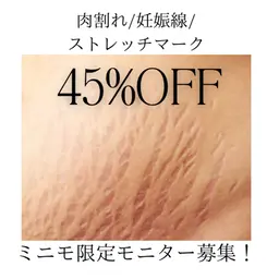 【モニター募集】ボディのたるみ◎妊娠線/肉割れの集中ケア