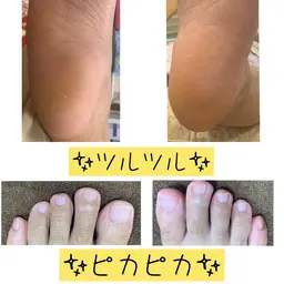 フットケア　素足べっぴんさんフルコースあなたのお足をツルツル✨ピカピカ✨にオイルリフレでしっかり保湿♫癒やされてください