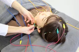 【リフトアップ】コラーゲンアップ再生美容鍼（通電付き）＋ヘッドマッサージ付き