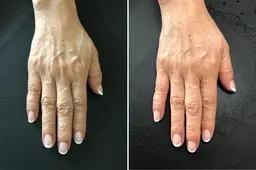 【全員】手の病院サロン、スタンダードコース