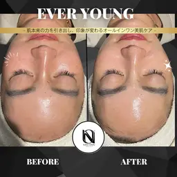 【✨1回で肌印象UP】EVER YOUNG｜うるおい・ハリ・毛穴ケアをまとめてサポート〈メンズOK〉