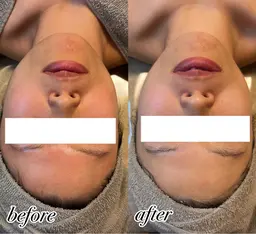 筋膜リリースコース🫧