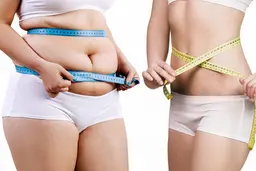 【結果重視の痩身＆美肌】1番人気プレミアムダイエットコース 初回特別価格