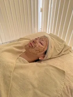 【学生応援】ニキビケア・毛穴ケア肌悩み撲滅ハーブピーリング！