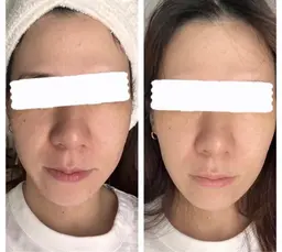 ヒト幹細胞導入コース