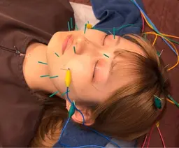 🎀 ご褒美に🎀 美容鍼 ➕鍼灸マッサージ➕骨盤矯正➕ヘッドマッサージ