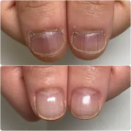 深爪・自爪育成無料カウンセリング