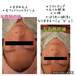 顔コリリセット！🍀だけしたい方✨