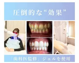 セルフホワイトニング