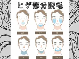 メンズ髭脱毛■1箇所（鼻下／口下／頬／首／顎)
