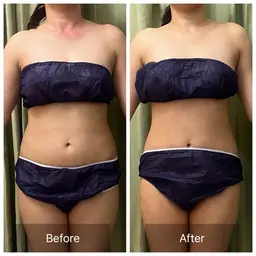 【ビフォアフ撮影可能な方】腸もみ筋膜×痩身✨くびれ引き締めや便秘解消に！30分