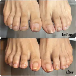 自爪育成【クリアジェル】フット👣