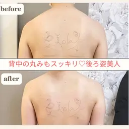 メリハリボディをつくるなら全身筋膜リリース👯‍♀️根本から改善しダイエットしやすい身体へ✨身体もスッキリ軽くなります✨