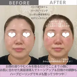 -３キロ⁈小顔、整顔マッサージ