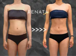 全員使える／冷却❄️痩身 お好きな部位8箇所モニター