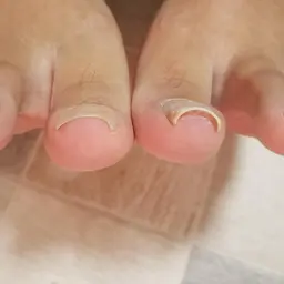 韓国から上陸！ヘイスイッチ！巻き爪の方におすすめ！1本～