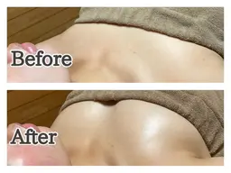 【モニター】デコルテからふっくらバストアップ