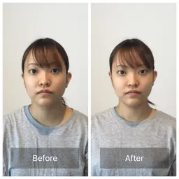 『施術後アンケート』ミニモ限定小顔ケアと骨盤ケア＋お悩み別OP50分¥15900-＜小顔解消/小顔姿勢/顔のバランス＞