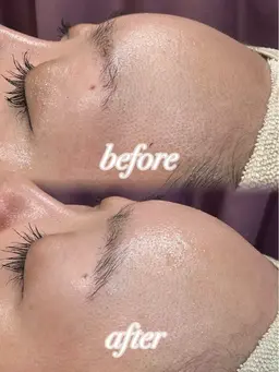 《上半身ケア》顔＋腕(肩から肘まで)＋背中半分＋うなじシェービング＋保湿パック🎐🩵