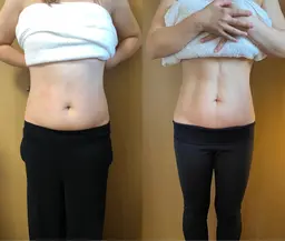 人気No1♡【下腹スッキリ！】腸もみで女性らしいキュッと引き締まったウエストGET(120分)