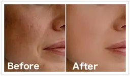 🔶美顔🔶【くすみ・シミケア＋しわ乾燥改善】瞬間透明感UP！肌が目覚める美白力♪幹細胞培養液+豚・馬プラセンタ高配合！