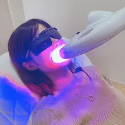 セルフホワイトニング【カウンセリング】