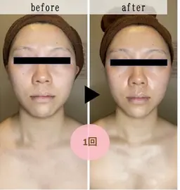 【むくみ｜顔コリ｜疲れ顔】小顔リンパマッサージ