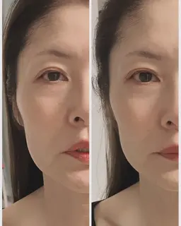 💆‍♀️【30分】小顔リフトアップドライヘッドスパ