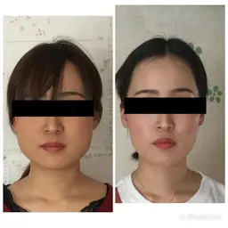 【新規】【ソフトタッチ&長持ち小顔矯正】エンドリングフェイシャル60分