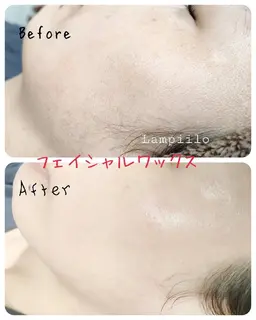 フェイシャルワックス(顔全体・パック付き)