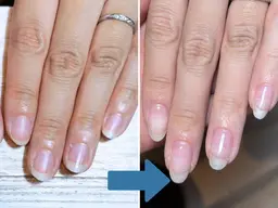 デザイン・カラーを楽しみながら縦長爪育成【横爪/爪割れ/二枚爪/小さい爪/丸爪】デザイン◎自爪風◎16500→