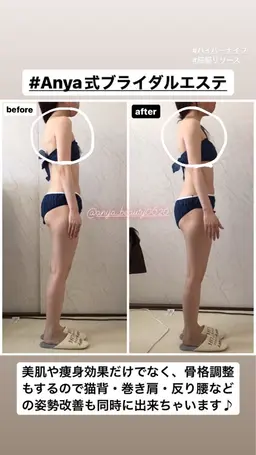 人気のブライダルエステお試し☆二の腕背中デコルテ｛ハイパーナイフ＆ハイパーウェーブ｝60分