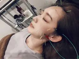 ⭐️美容鍼、60分マッサージ(整体)セット⭐️