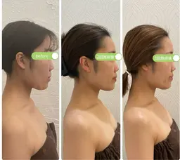 全国にたった6名の認定講師の施術が受けられる!整形級✨頭蓋骨小顔矯正体験