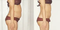 【3月限定✨】マグニート痩身 無料体験