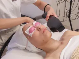 【レディース】お顔脱毛🌟うぶ毛、ムダ毛、くすみ解消!ちゅるりんお肌作り ¥3600保湿クリーム付き