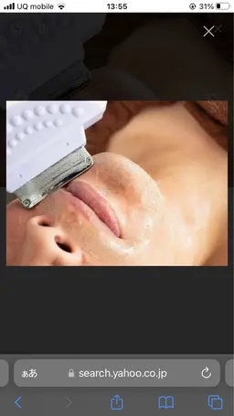 【男性限定👨毎朝の面倒なひげ剃りを卒業✨】ひげ脱毛（顎、鼻下のみ）