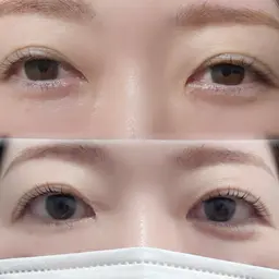 ラッシュリフト