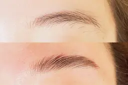 ハリウッドブロウリフト