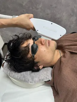 【再来】メンズ ヒゲ脱毛