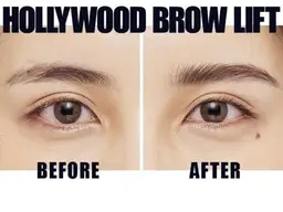 ハリウッドブロウリフト